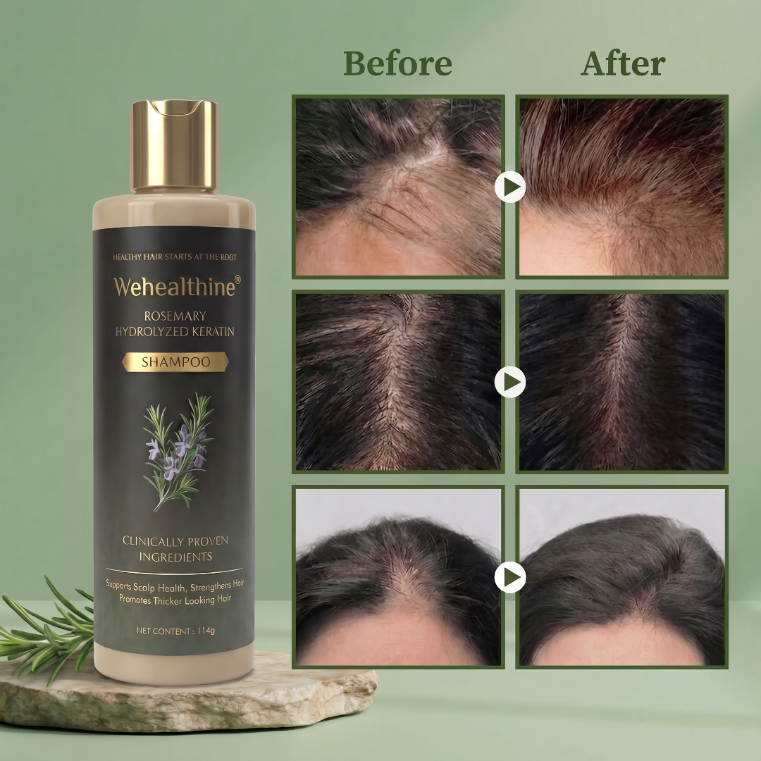 Rosemary keratin shampoo with before and after hair density references